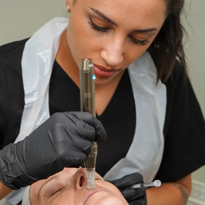 Microneedling